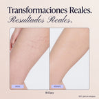 Rovvec™ Body Coverage Perfector