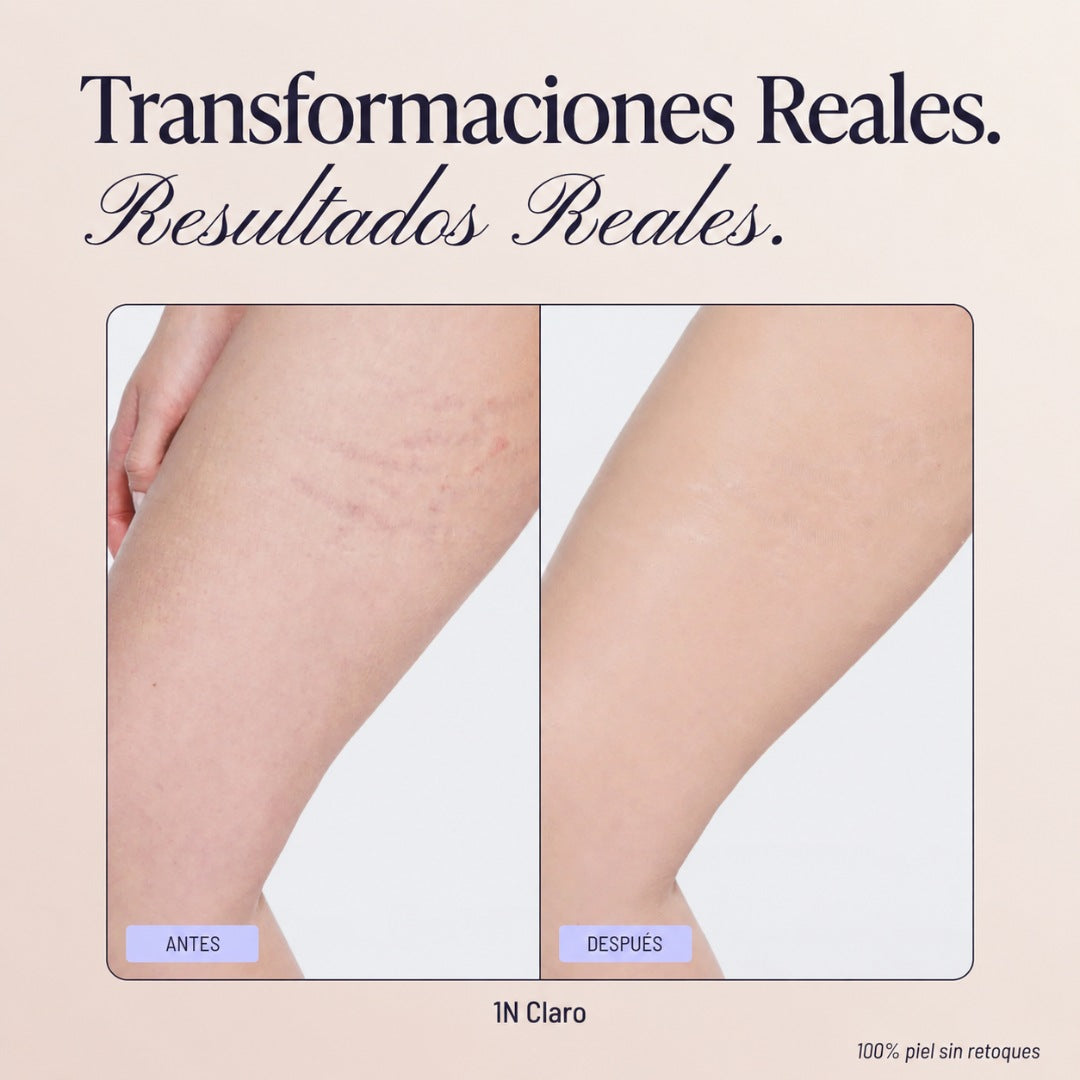 Rovvec™ Body Coverage Perfector