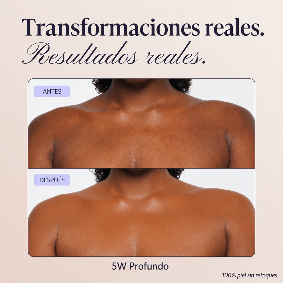 Rovvec™ Body Coverage Perfector